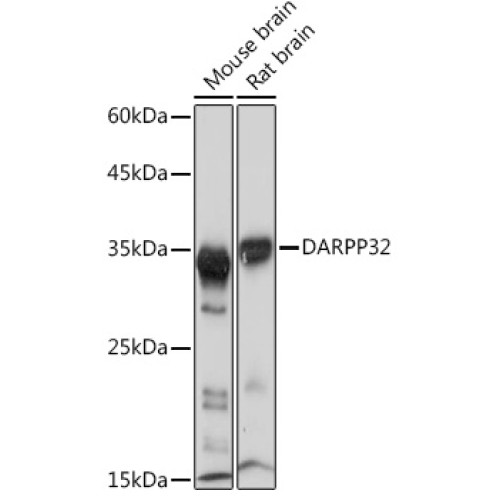 DARPP32 Rabbit mAb