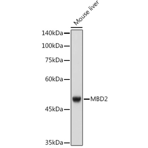 MBD2 Rabbit mAb