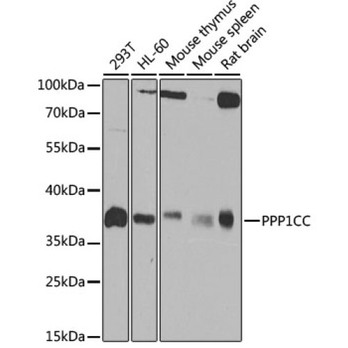 [KO Validated] PPP1CC Rabbit pAb