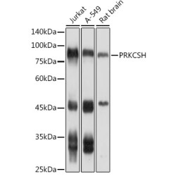 PRKCSH Rabbit pAb