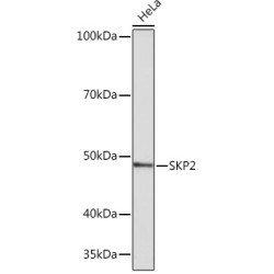 SKP2 Rabbit mAb