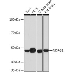 NDRG1 Rabbit mAb