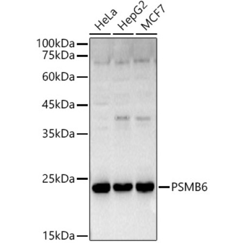 PSMB6 Rabbit pAb