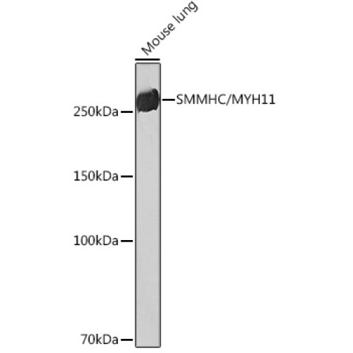 SMMHC/MYH11 Rabbit mAb
