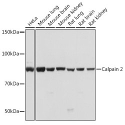 Calpain 2 Rabbit mAb