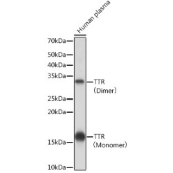 TTR Rabbit mAb