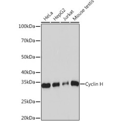 Cyclin H Rabbit mAb