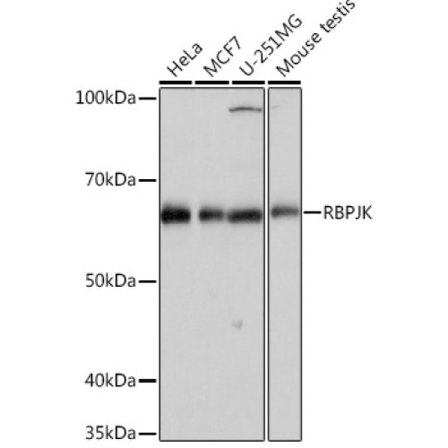 RBPJK Rabbit mAb