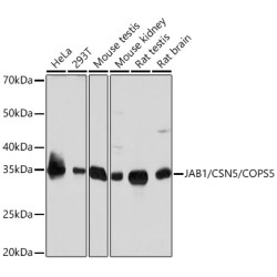 JAB1/CSN5/COPS5 Rabbit mAb