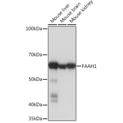 FAAH1 Rabbit mAb