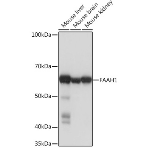 FAAH1 Rabbit mAb