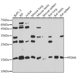 PFDN5 Rabbit mAb