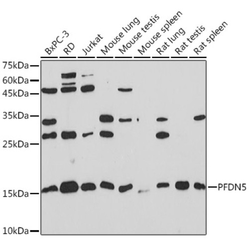 PFDN5 Rabbit mAb