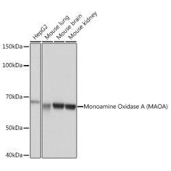 Monoamine Oxidase A (MAOA) Rabbit mAb