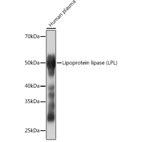 Lipoprotein lipase (LPL) Rabbit mAb