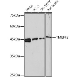 TMEFF2 Rabbit mAb