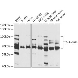 SLC20A1 Rabbit pAb