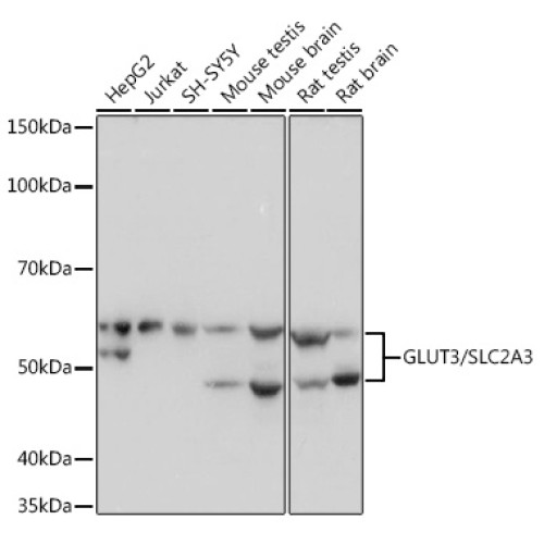 GLUT3/SLC2A3 Rabbit mAb