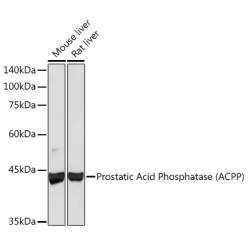 Prostatic Acid Phosphatase (ACPP) Rabbit mAb