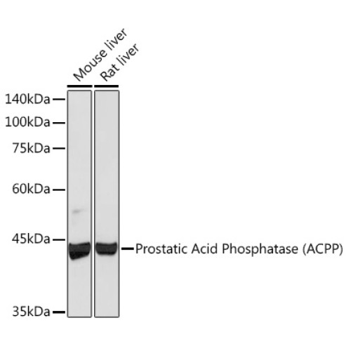 Prostatic Acid Phosphatase (ACPP) Rabbit mAb