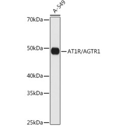 AT1R/AGTR1 Rabbit mAb