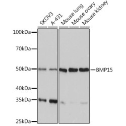 BMP15 Rabbit mAb