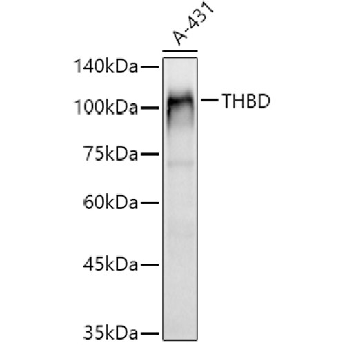 CD141/Thrombomodulin Rabbit pAb