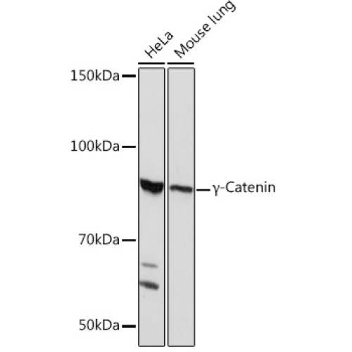 γ-Catenin Rabbit mAb