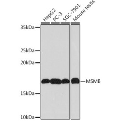 MSMB Rabbit mAb