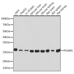 PGAM1 Rabbit mAb