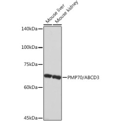 PMP70/ABCD3 Rabbit mAb