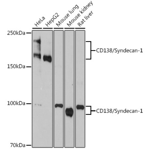 CD138/Syndecan-1 Rabbit mAb