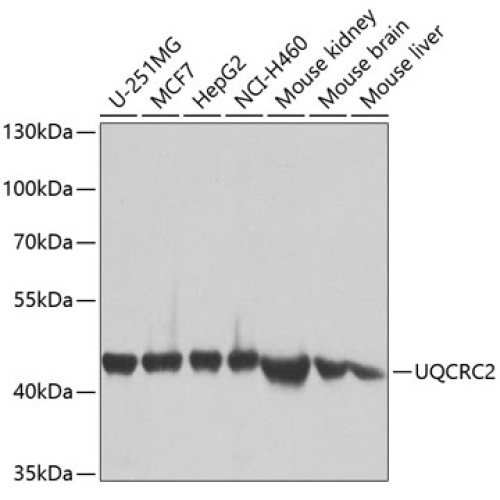 UQCRC2 Rabbit pAb