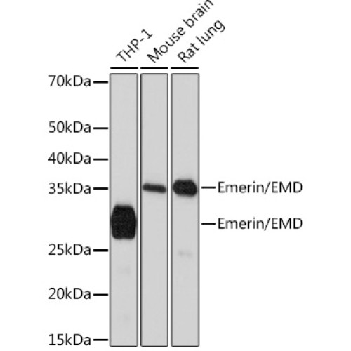 Emerin/EMD Rabbit mAb