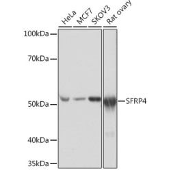 SFRP4 Rabbit mAb