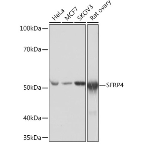 SFRP4 Rabbit mAb