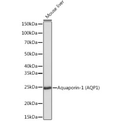 Aquaporin-1 (AQP1) Rabbit mAb