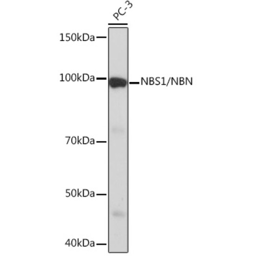 NBS1/NBN Rabbit mAb