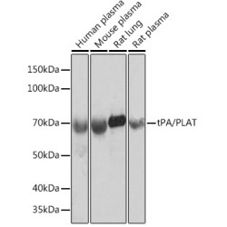 tPA/PLAT Rabbit mAb