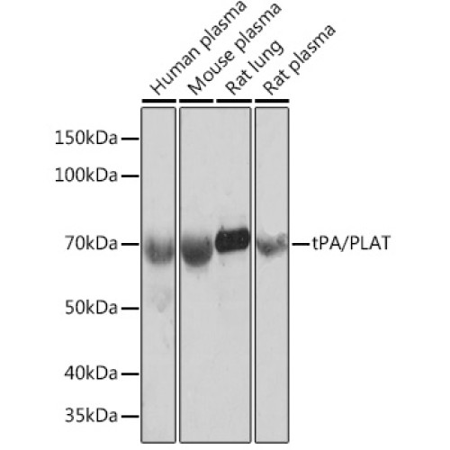 tPA/PLAT Rabbit mAb