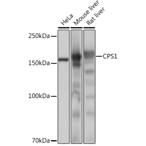 CPS1 Rabbit mAb