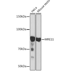 MRE11 Rabbit mAb
