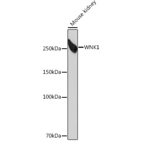 WNK1 Rabbit mAb