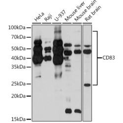 CD83 Rabbit mAb