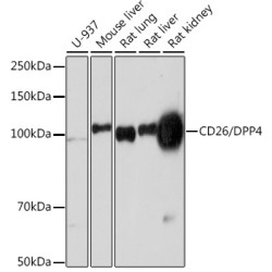CD26/DPP4 Rabbit mAb