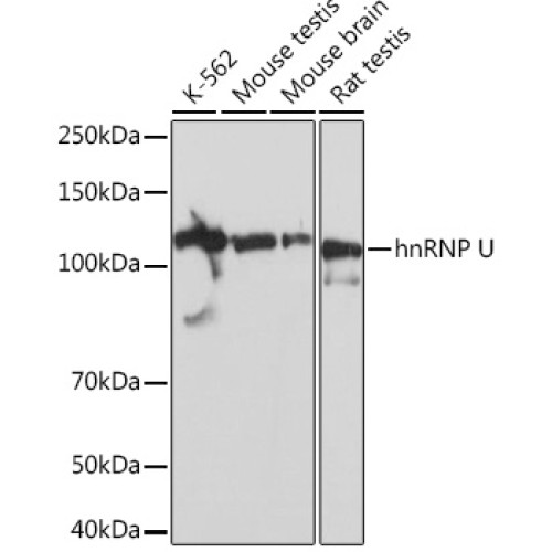 hnRNP U Rabbit mAb