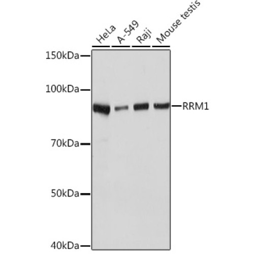 RRM1 Rabbit mAb