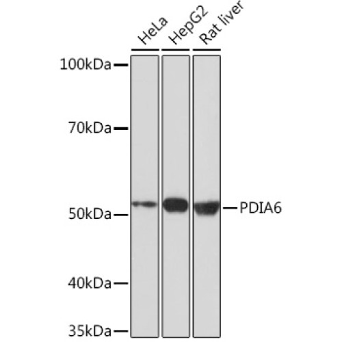 PDIA6 Rabbit mAb