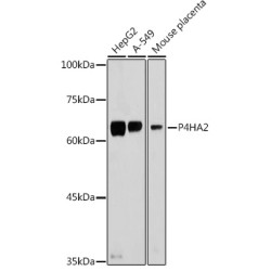 P4HA2 Rabbit pAb