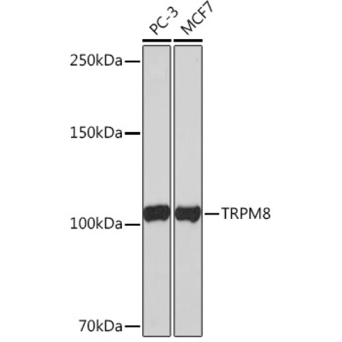 TRPM8 Rabbit mAb